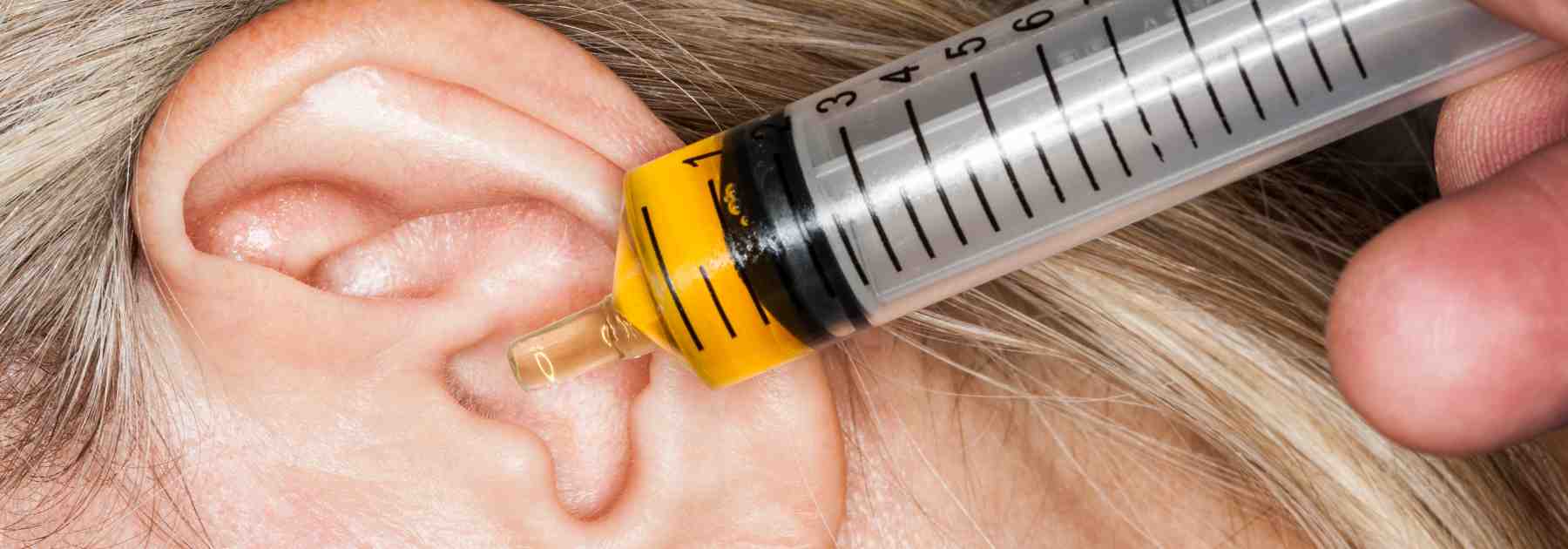 Compare olive oil ear drops and professional removal