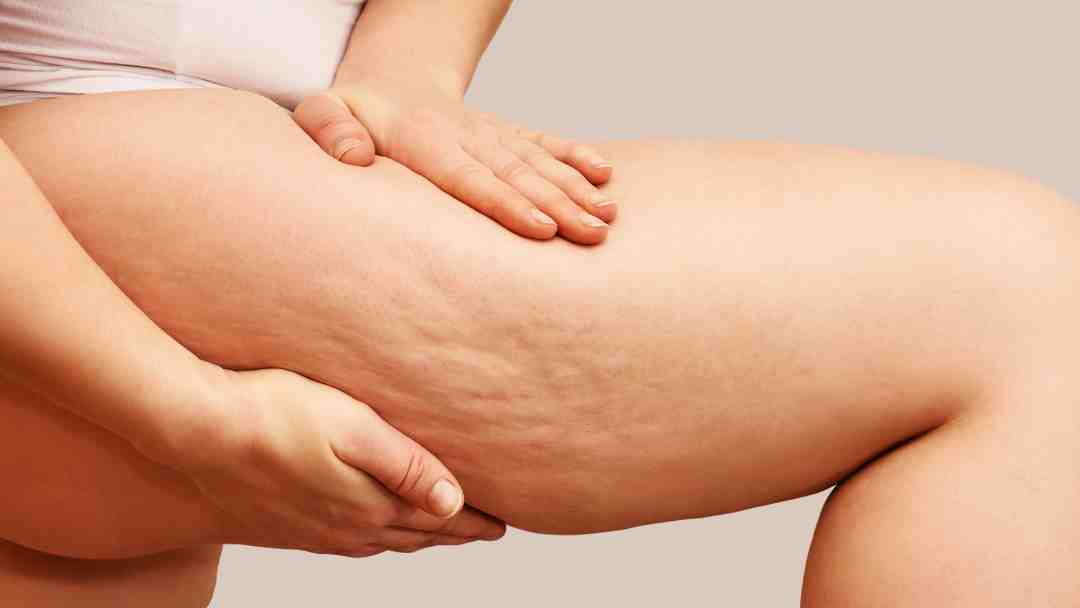 How to inject Mounjaro to optimise results