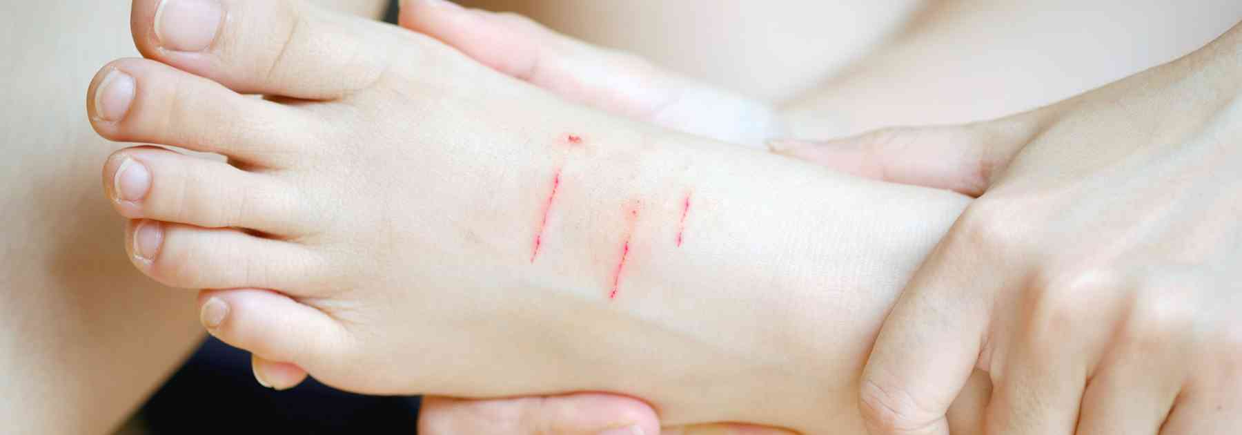 How long does the rabies vaccine last?